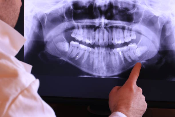 Dentist for Dental Trauma in NC